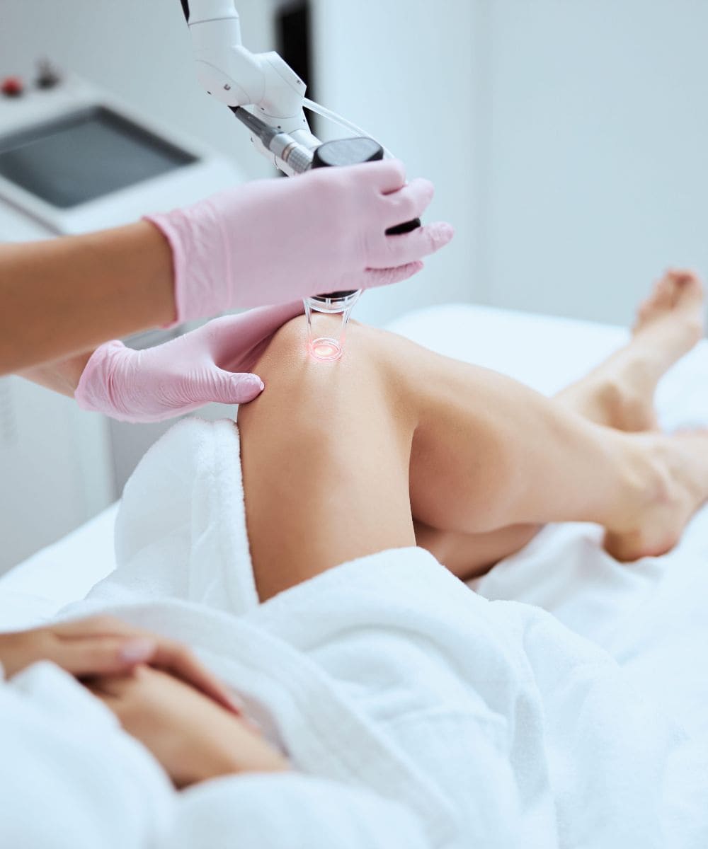 Vascular lesions image