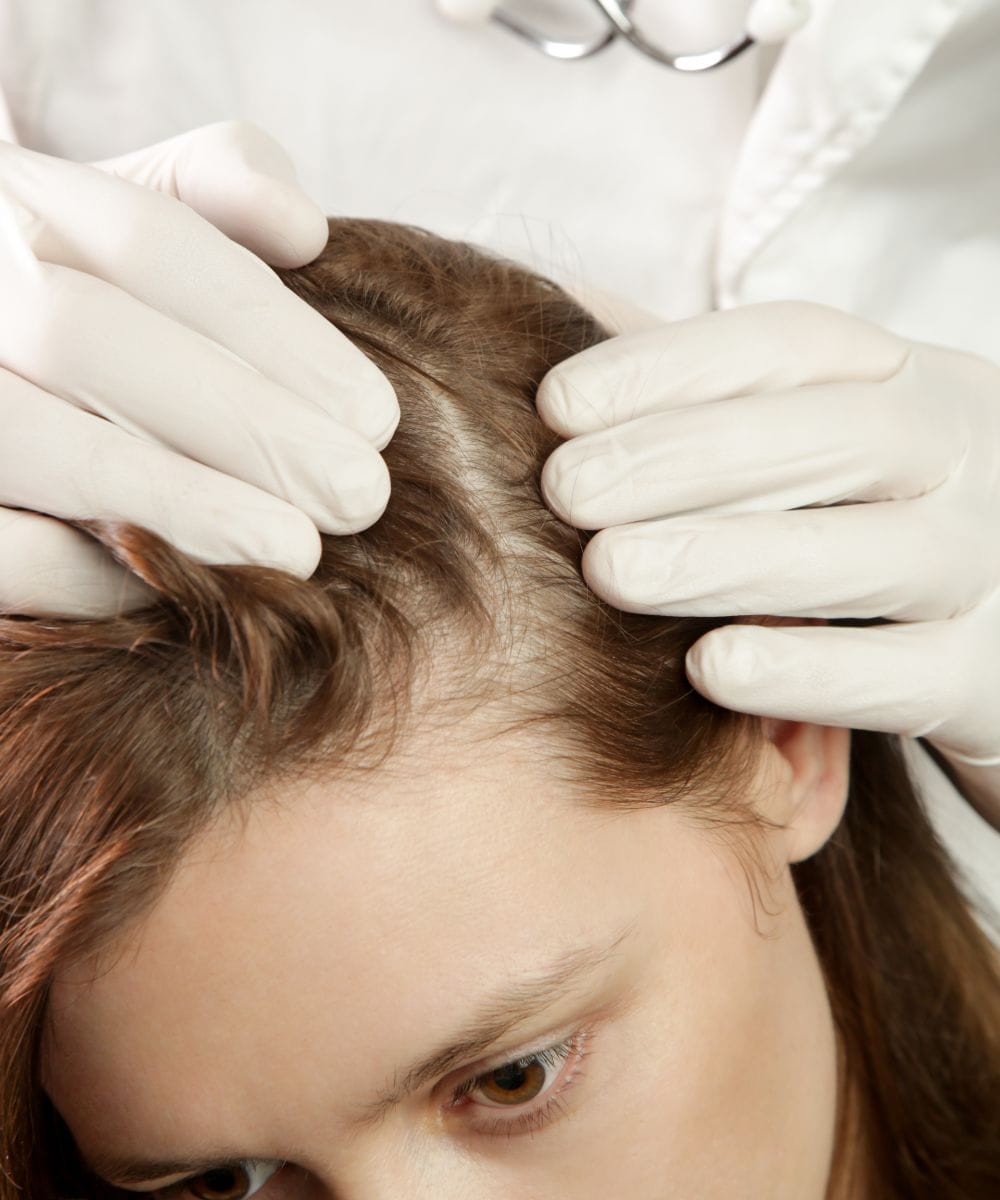 hair loss (7)
