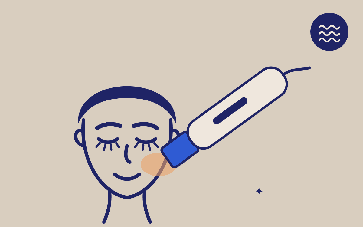 XTherma RF handpiece on the cheek