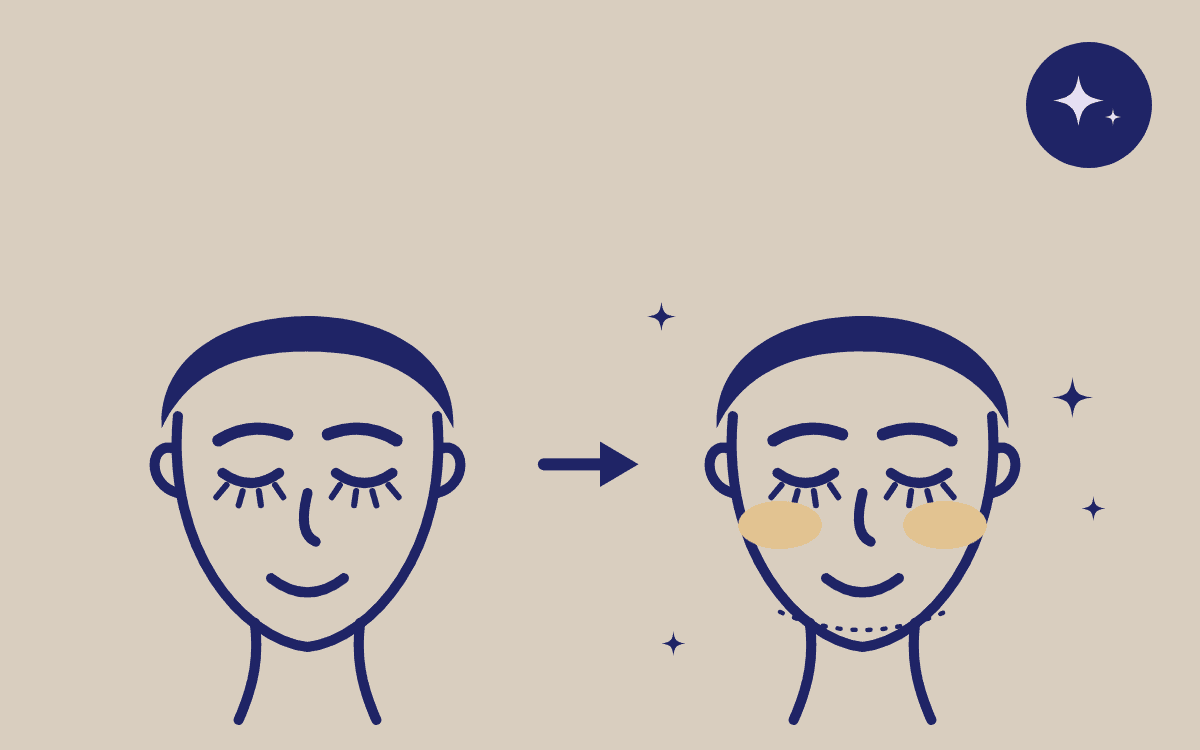 Firmer skin after XTherma treatment