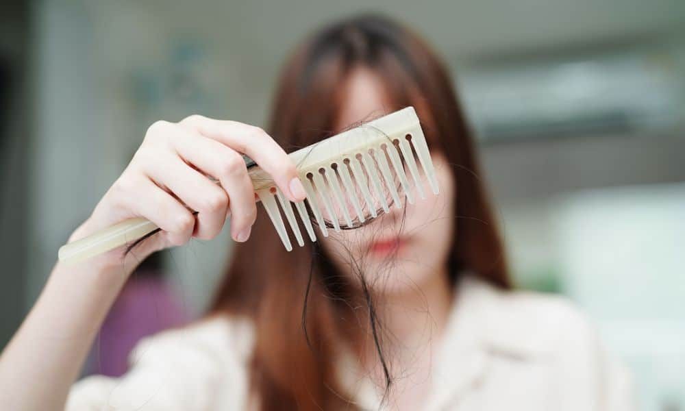 Hair loss image